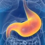 癌的啟示：腸胃道基質瘤 1/3患者無病徵 (2013年5月30日)